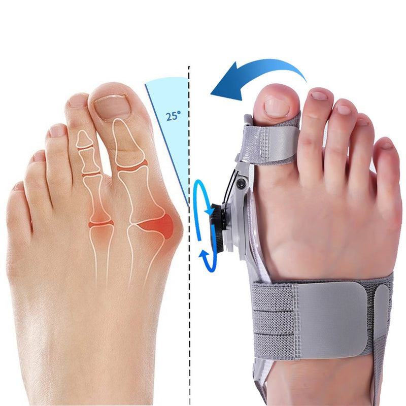 Curavi Bunion Aligner